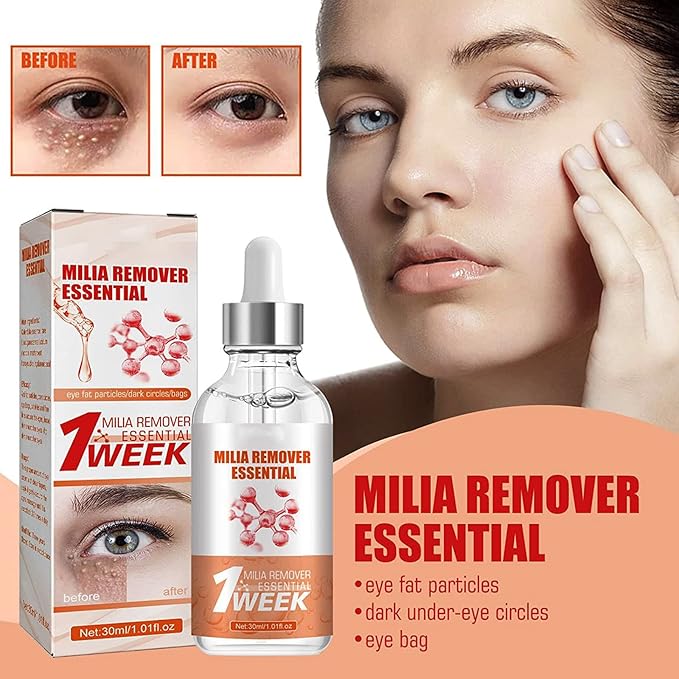 Smooth Milia Remover Serum | (30ml) | (original)