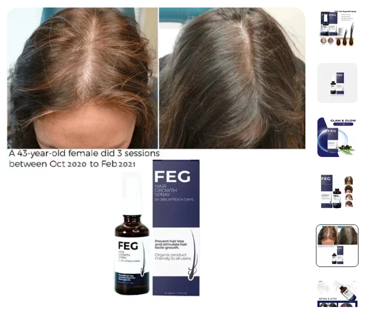 FEG | Hair Growth Spray | (original) | Trusted by millions  (for UAE only)