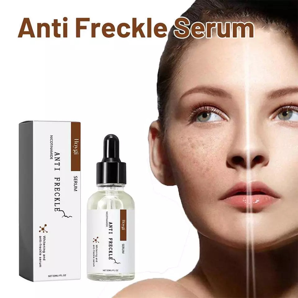 Hoyji  Anti Freckle Serum | (30ml) | (original)